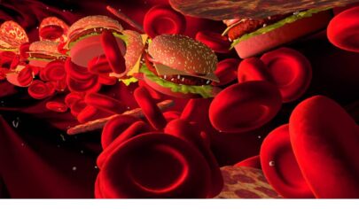 راه های کاهش چربی خون قاتل چربی خون